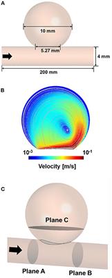 Computational Study of Hemodynamic Changes Induced by Overlapping and Compacting of Stents and Flow Diverter in Cerebral Aneurysms